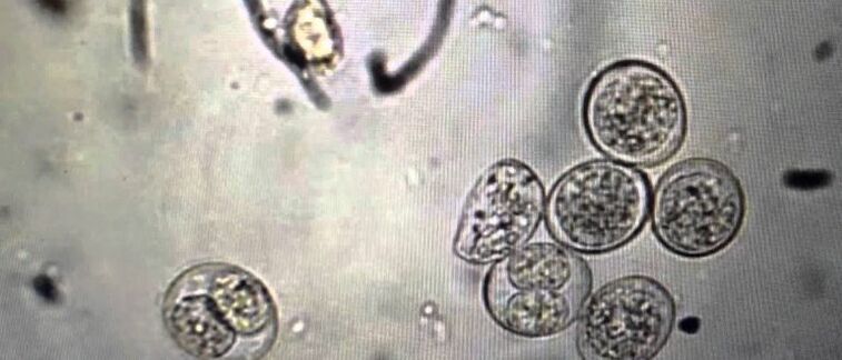 protozoan parazit hücreleri